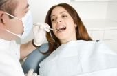 Hersteltijd van implantaatchirurgie tand