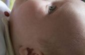 Hoe te zetten In Baby oogdruppels