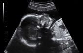 Ontwikkeling van een foetus Baby 6 maanden