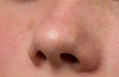 Hoe te genezen van een neus Ring infectie