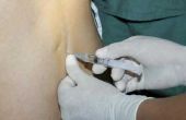 Hoe voor te bereiden voor epidurale steroïde injecties voor rug & beenpijn