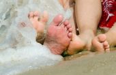 How to Get Rid van droge, krokant huid op mijn voeten natuurlijk