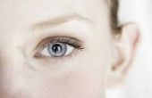 De beste behandelingen te verminderen ogen wallen