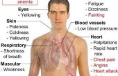 Symptomen van anemie bij volwassenen