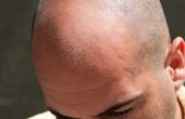 Het elimineren van de glans van een kaal hoofd