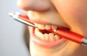 Het verwijderen van vlekken van tandheelkundige Bonding