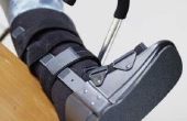 Immobilisatie met orthopedische schoen instructies