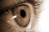 Waarom doen mensen hebben bruine vlekken in hun ogen?
