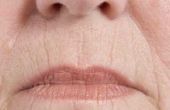 Hoe te voorkomen dat de lijnen van de Lip