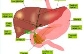 Tekenen & symptomen van cirrose van de lever