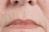 Grote behandelingen voor rimpels rond de lippen