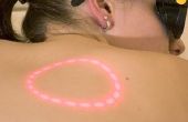 Hoe de zorg voor de huid na Laser Ontharing