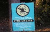 Cardiale symptomen van de ziekte van Lyme