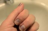Hoe Dye om vlekken te verwijderen van de nagels