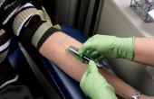 Over de schade aan de zenuwen door het doneren van bloed