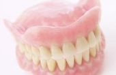 Het verschil tussen porseleinen tanden & acryl tanden