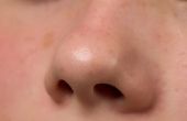 Tips voor een hangende neus