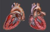 Wat is de milde Cardiomegaly?