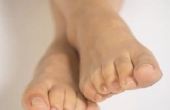 Hoe om te voorkomen dat je voeten pijn na staan