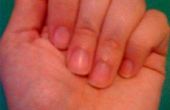 Hoe krijg ik vlekken van nagellak uit nagels