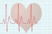 Hoe voor te bereiden voor een Echocardiogram