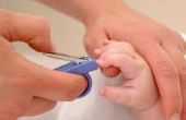 Hoe om te knippen van de nagels van een kind met sensorische Processing Issues