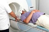 Salaris van een radiologisch MRI