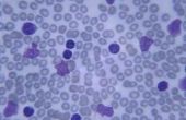 De functionele kenmerken van leukocyten