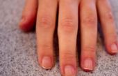 Hoe om vlekken te verwijderen van uw nagels