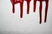 Hoe te verwijderen van bloedvlekken op kleding