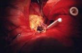Het beginsalaris voor een Cardiothoracale chirurg