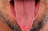 Het gebruik van zout om te genezen van witte tong