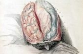 Tekenen van schade aan de zenuwen in de hersenen