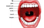 Angina pectoris keel symptomen