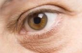 Hoe maak je je ogen mooier: vermindering van wallen en donkere kringen