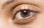 How to Make ogen kijken minder gezwollen