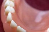 Hoe te voorkomen dat een Gag-Reflex met valse tanden