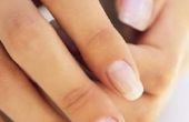 Hoe om te voorkomen dat mijn nagels schilferen af