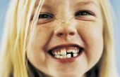 Hoe borstel tanden van kinderen