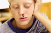 Wat zijn de oorzaken van neus bloedt bij kinderen?