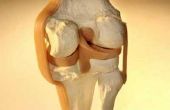 Gescheurde knie Ligament symptomen