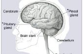 Tekenen & symptomen van vloeistof op de hersenen
