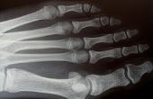 Wat zijn de voorwaarden voor een X-Ray technicus?