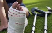 Hoe om te weten als je een been bot hebt gebroken