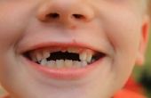 Op welke leeftijd kinderen verliezen hun tanden?