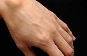 Hoe te weten of de Hand of pols pijn een Ganglion cyste is