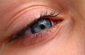 How to Spot ogen symptomen van hoge bloeddruk