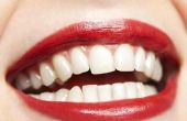 Wat zijn de overeenkomsten tussen eierschalen en tanden?