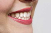 Tandsteen verwijderen Home Remedy