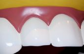 Hoe om te witten tanden met waterstofperoxide